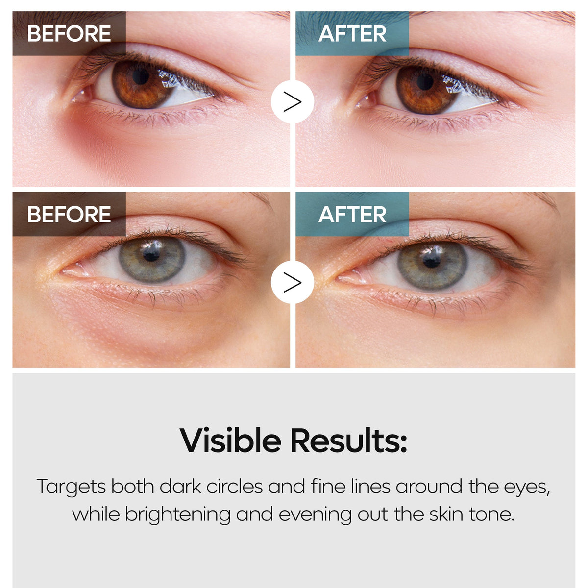 TX Retinalsome Double Effect Eyecream - image 6